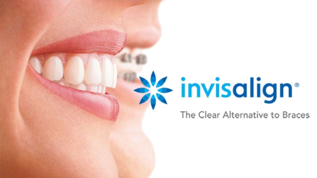 Rielo Dental : Invisalign Treatment in Hialeah