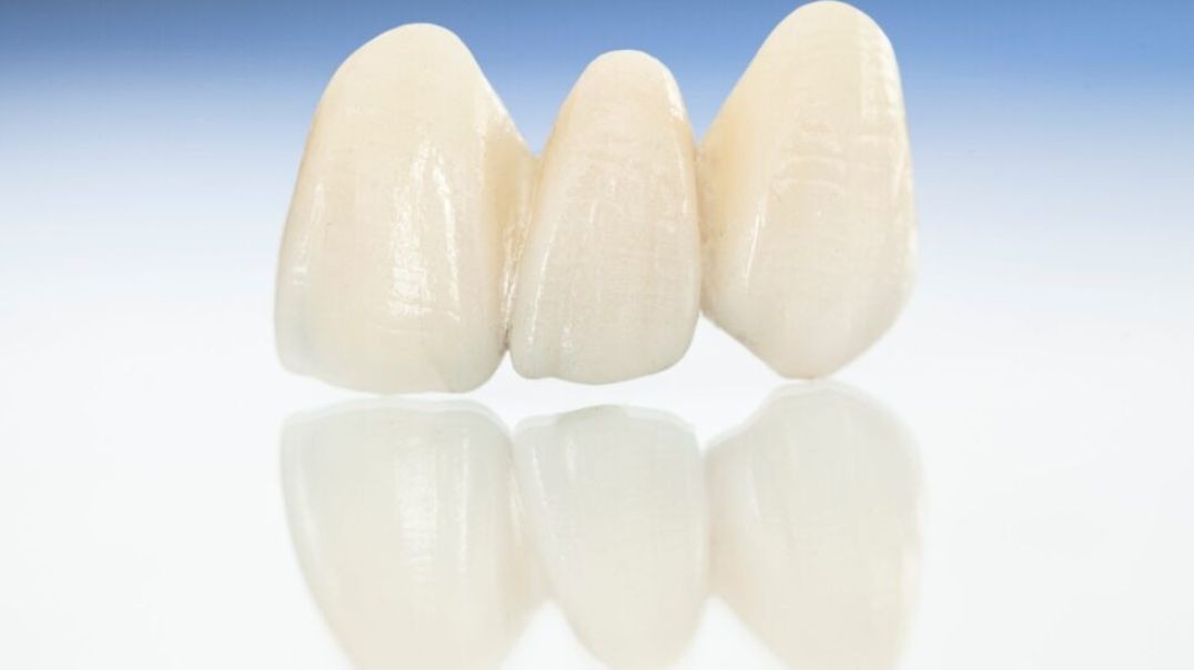 Advanced Dental Solutions : Dental Crown in Sunset