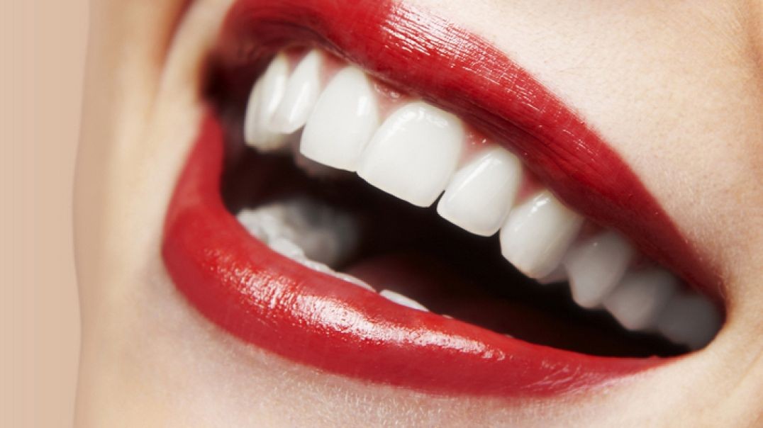 Rielo Dental Clinic : #1 Teeth Whitening in Hialeah, FL | 33012