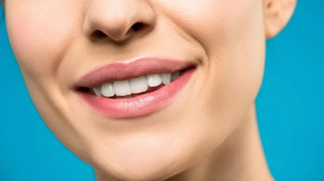 MSG Dental : #1 Teeth Whitening in Hialeah Gardens, FL | (786) 542-8954