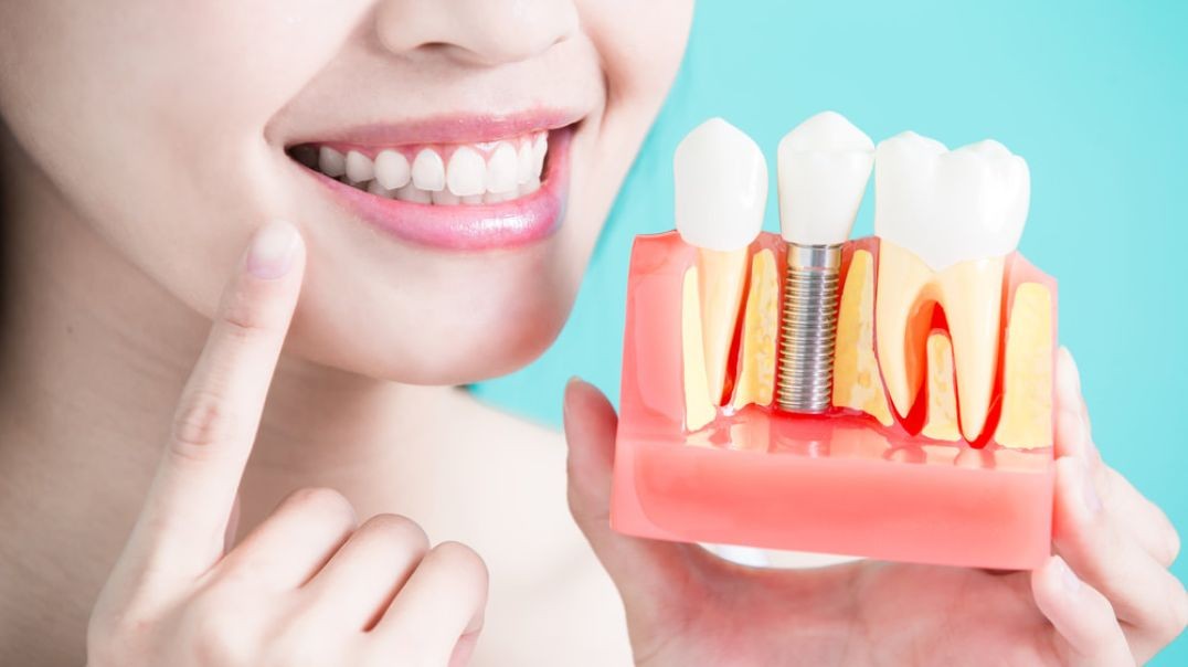 MSG Dental : Dental Implants in Hialeah Gardens, FL